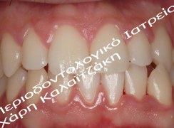 IMG_3854_ΒΚ